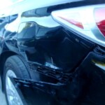Before and after photographs of a damaged Hyundai that was repaired by Elite Paint & Body Shop in West Palm Beach, FL