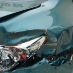 Before and After Pictures of a Toyota Corolla Fixed by Elite Paint & Body Shop