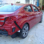 Before and after photographs of a damaged Hyundai Elantra that was repaired by Elite Paint & Body Shop